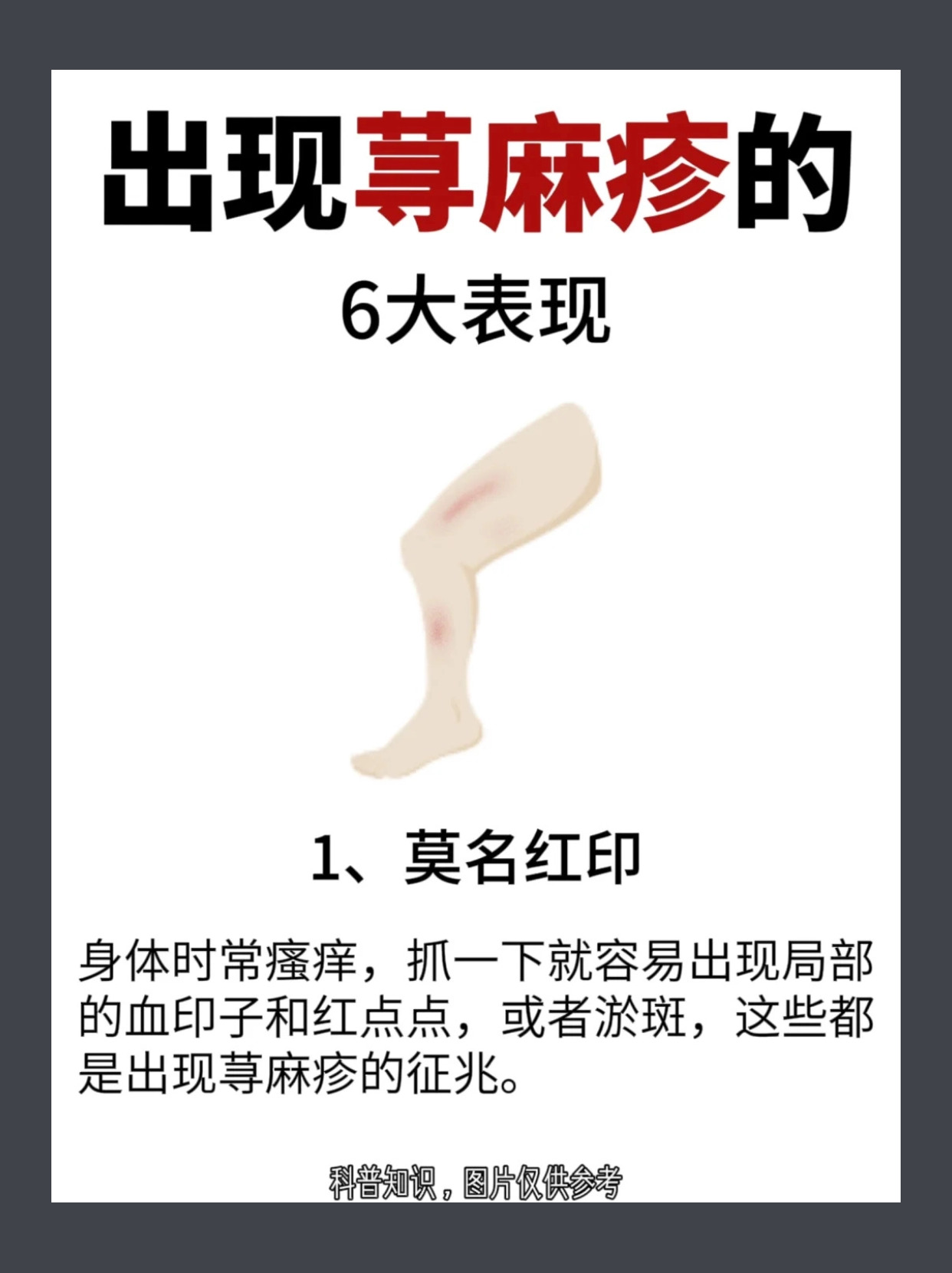 为什么突然得荨麻疹还一直不好为什么在线