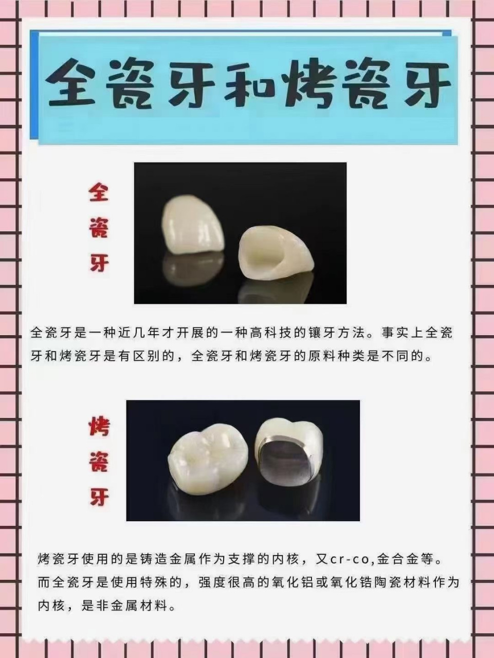 海淀中诺口腔医院#  全瓷牙vs烤瓷牙怎么选‼️||🦷 #暮春褂觋