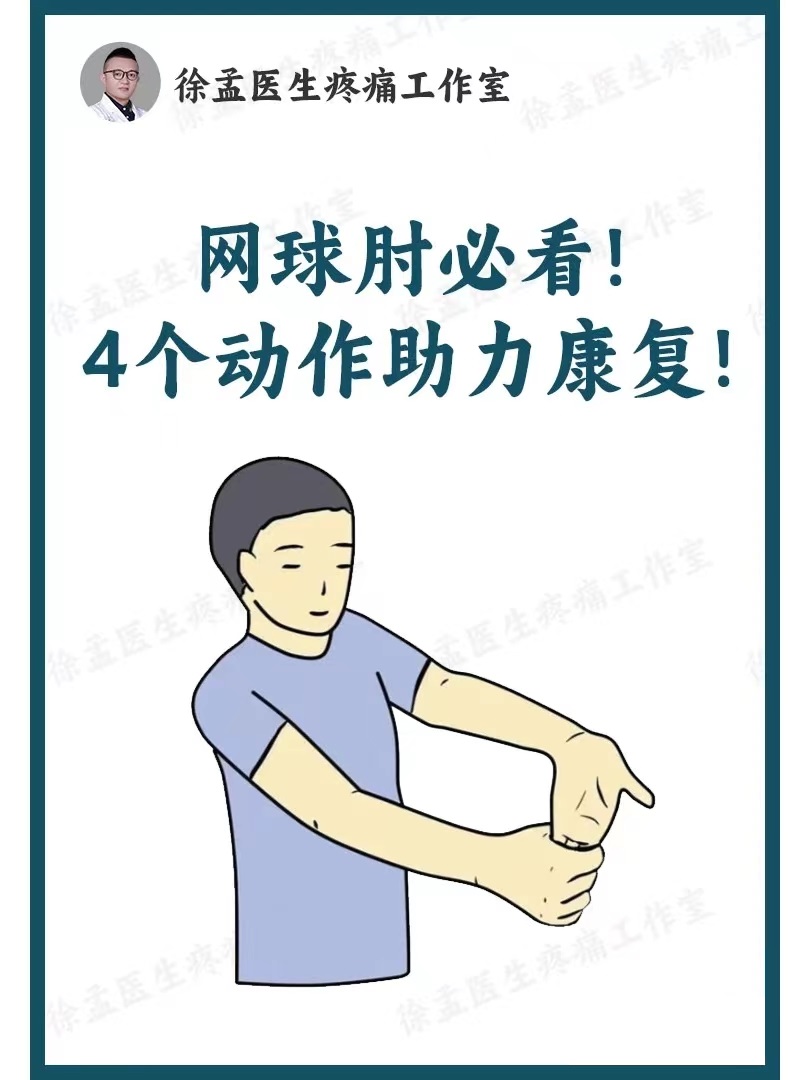 i健康发文pk赛#  网球肘疼痛必看~ 4个动作助力康复! 1.手指延伸 2.