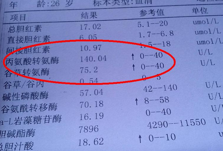 体检报告单中"转氨酶"偏高,意味着什么?医生为你一文科普