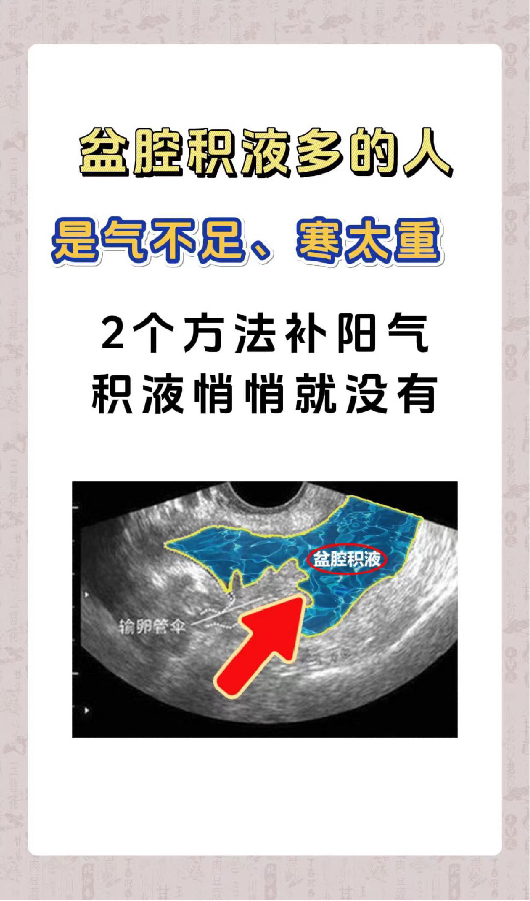 盆腔积液多的人,就是阳气太少了,2个方法,补阳气消积液#盆腔积液