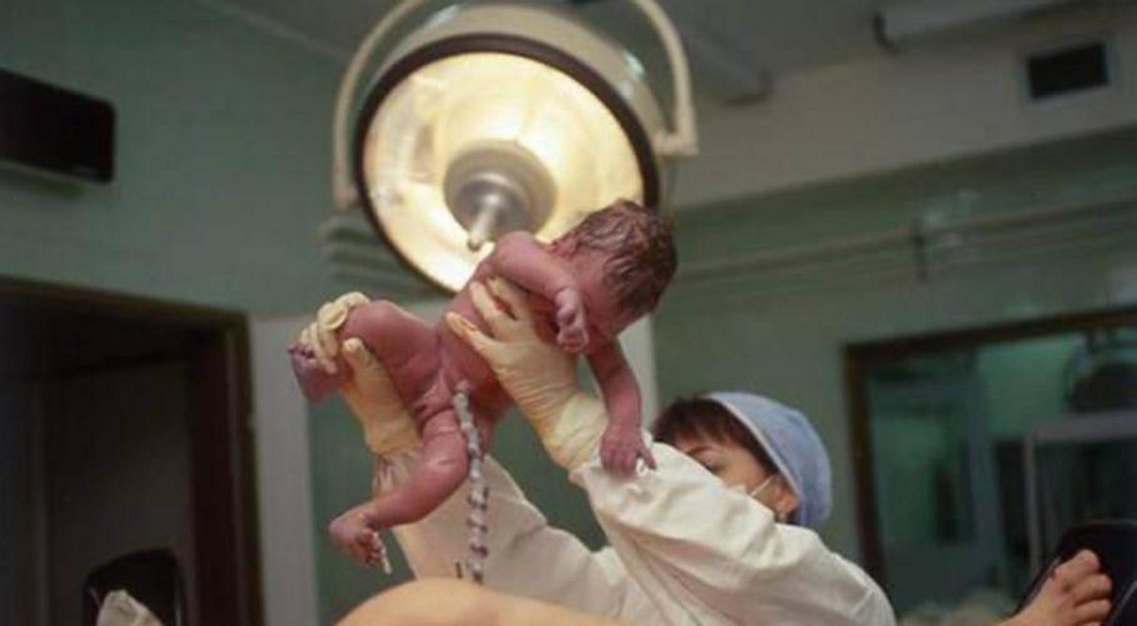 表妹怀孕39周,凌晨3点肚子疼,应该是睡的正香的时候,却要赶去医院准备