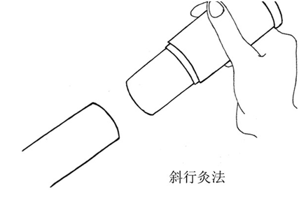 雷火灸图片 手法图片