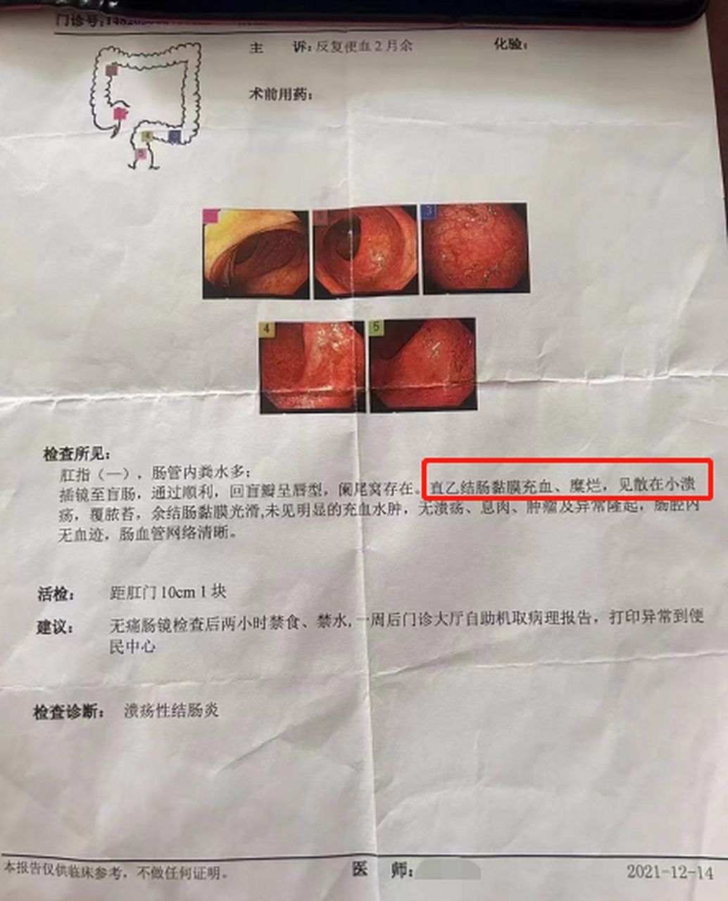 27岁的潘先生,上周发来复查的肠镜,一切都正常了,太为他高兴了!