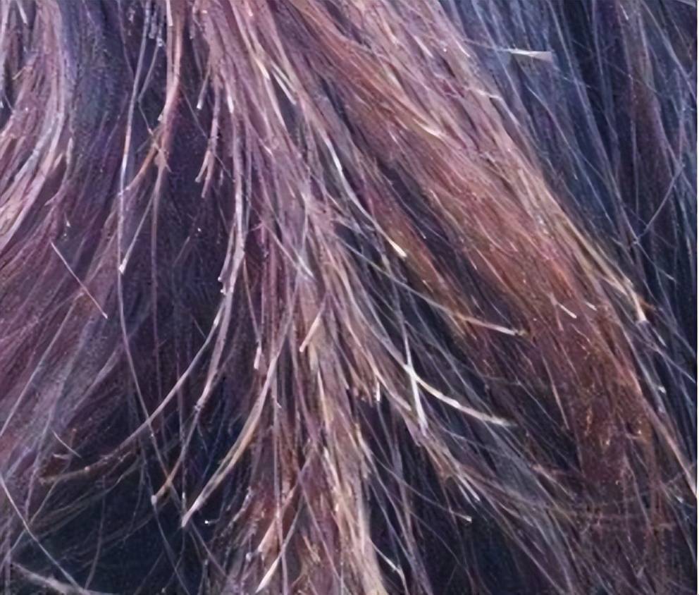 头发开叉,这个困扰众多爱美人士的头发问题,不仅影响外观,更是健康