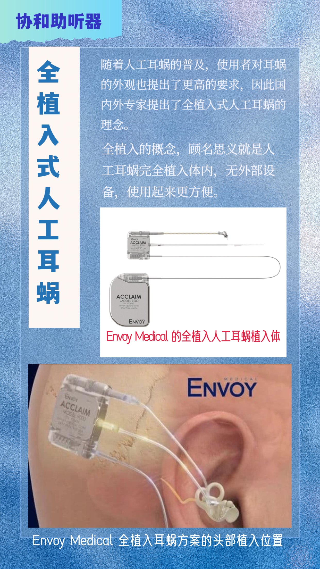 听友福音|全植入式人工耳蜗渐行渐近