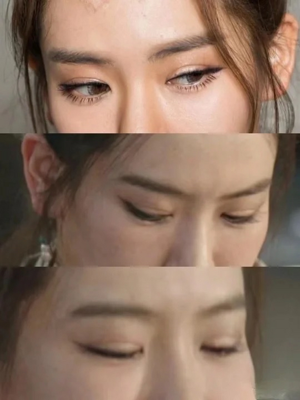 戚薇割了双眼皮后感觉眼睛没有以前好看了,明明之前眼睛的形状很灵动