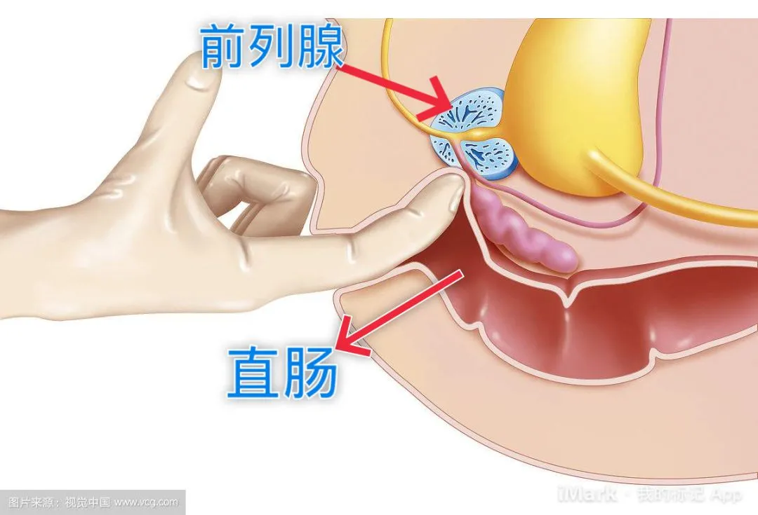 饮酒吸烟能治疗前列腺炎吗?