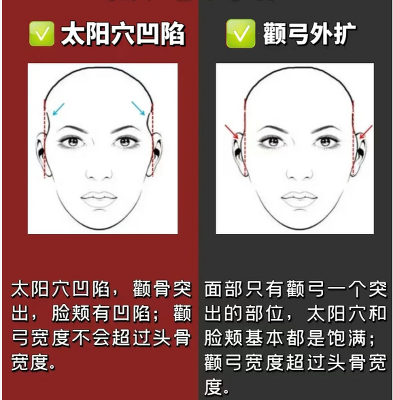 太阳骨的位置图解图片