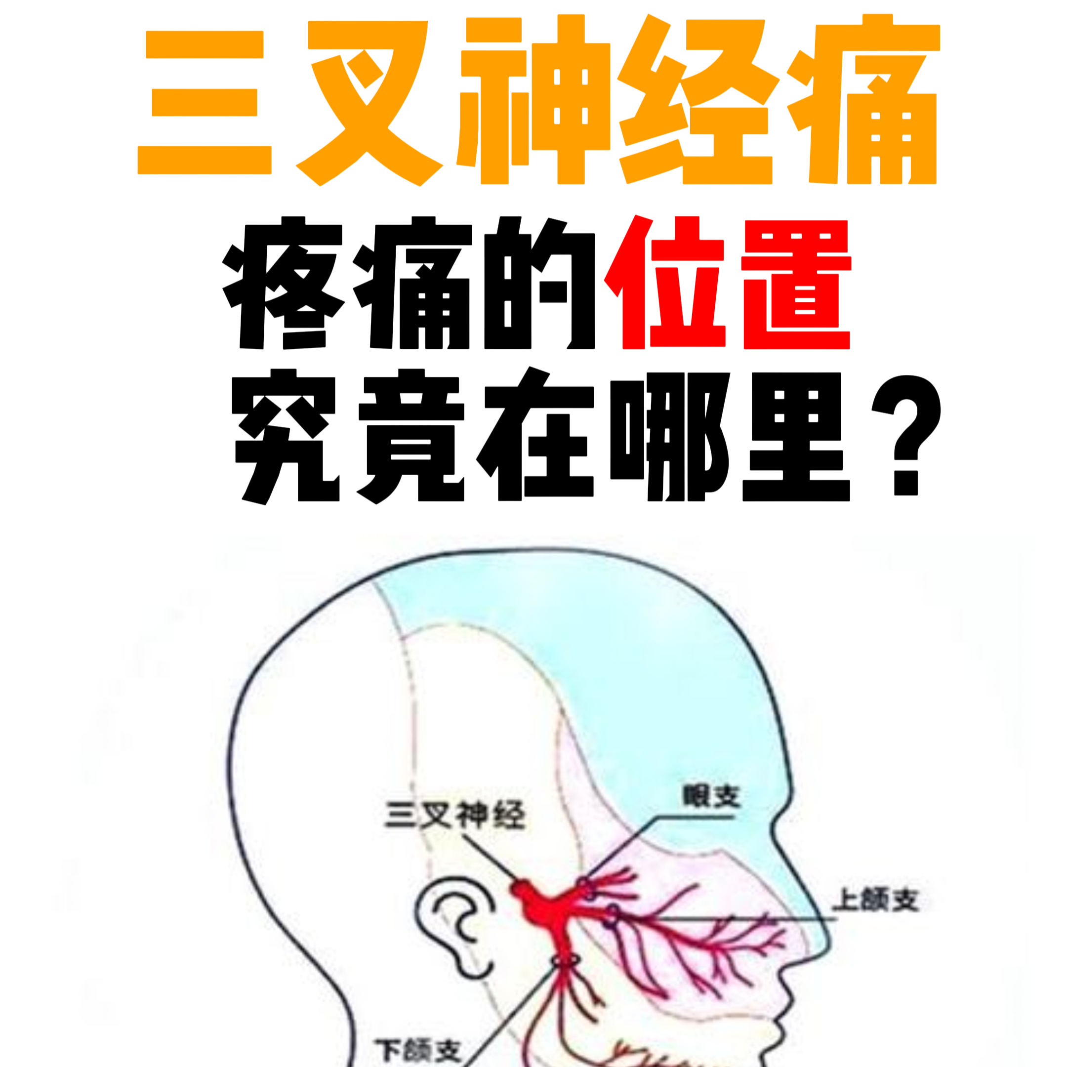 三叉神经在什么位置图片