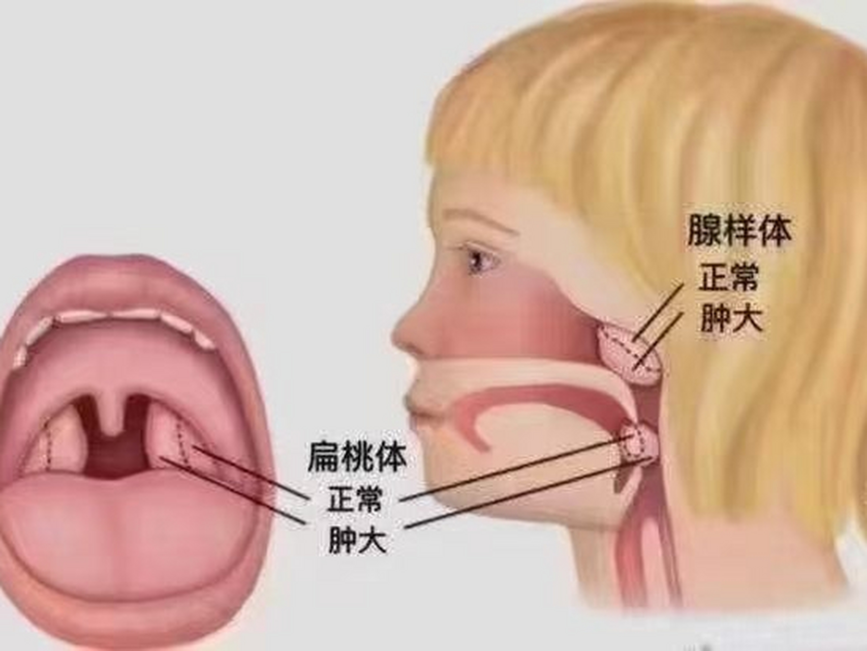 人体八大腺体准确位置图片