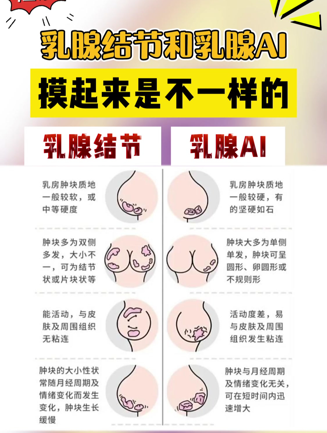 乳腺结节能摸出来吗图片