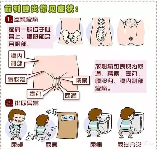 前列腺炎在哪个部位图图片