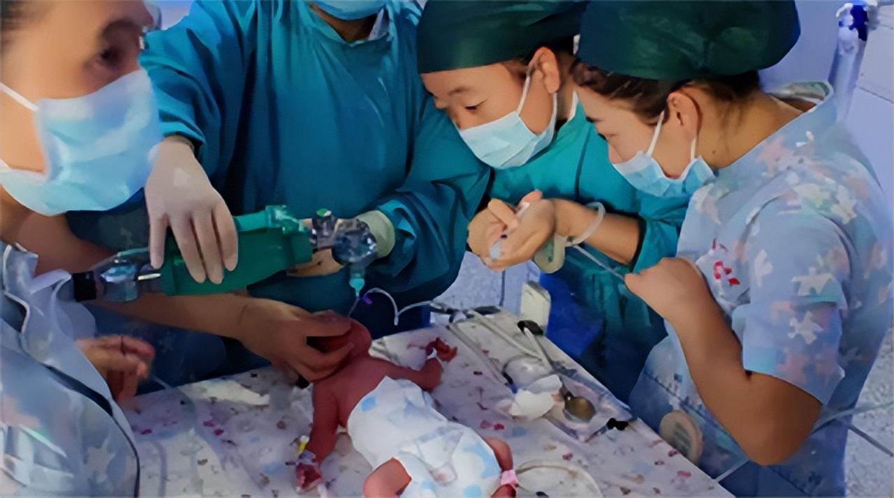 晴天霹雳——龙凤胎竟是脑瘫患儿