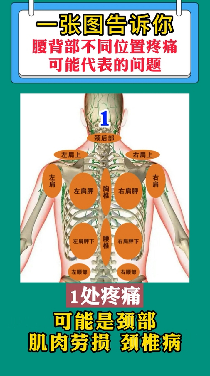 腰背部分区图图片