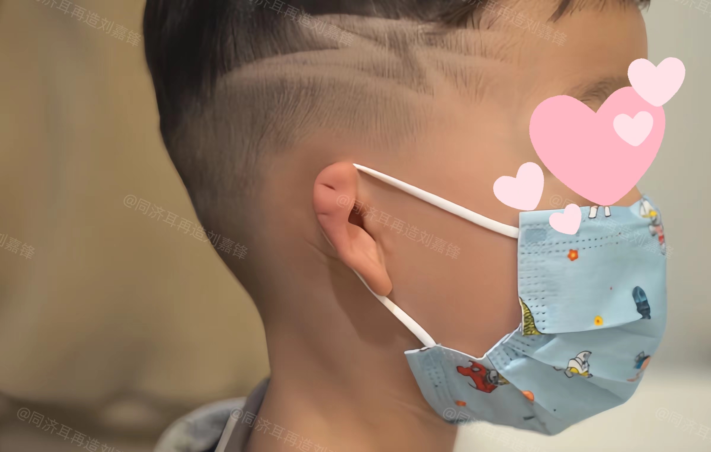 "  我摸了摸他的头,"哪里变形了?叔叔看看,肯定会帮你把耳朵变好的