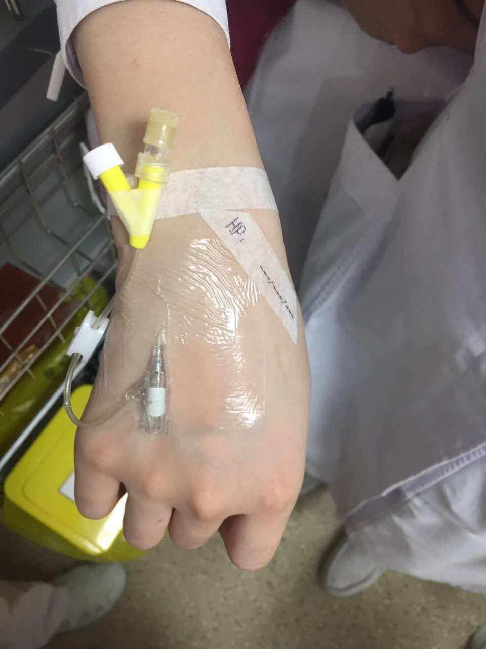 7厘米留置针滞留男童体内5年 家长:针头在血管内不断移动 留置针用