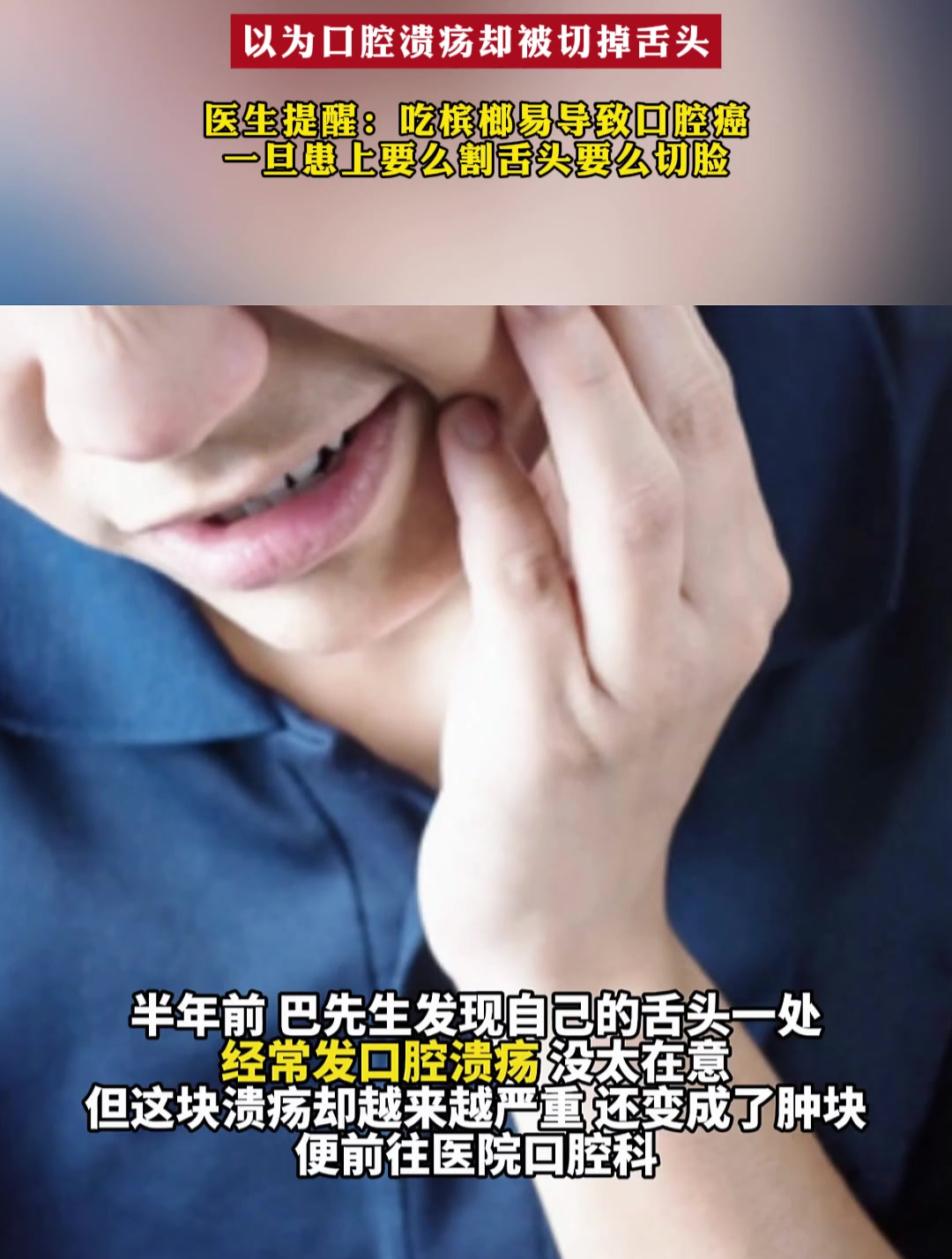 36岁男子天天嚼槟榔患舌癌,以为口腔溃疡却被切掉舌头