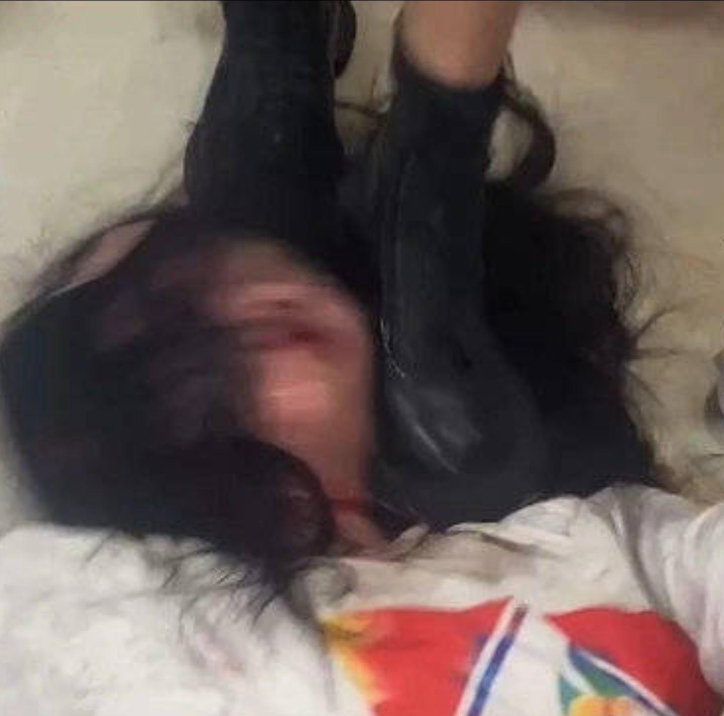 揪心!长沙女生遭霸凌后割喉,现场画面曝光,打人者发朋友圈炫耀
