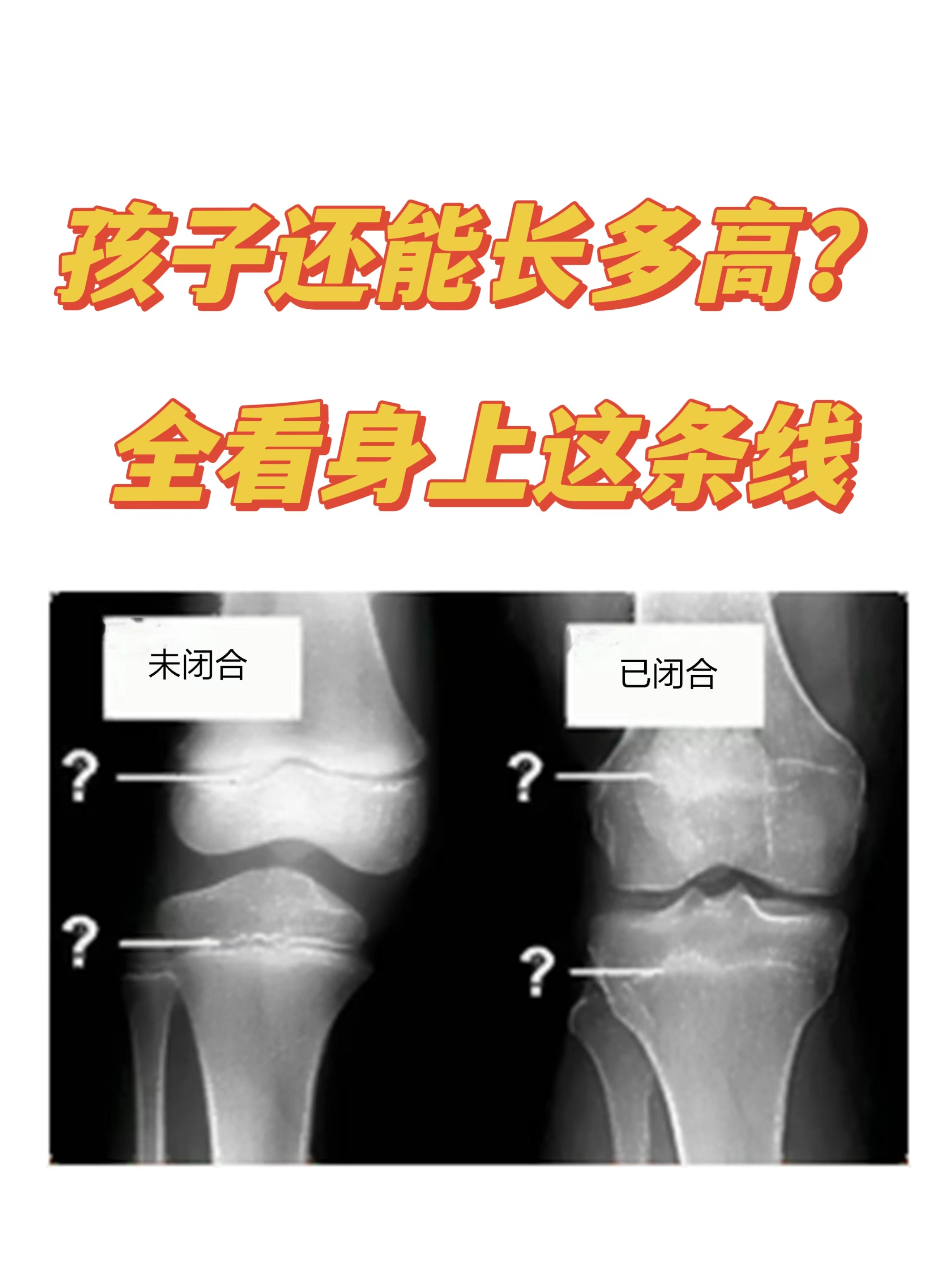 男生面部骨骼发育过程图片