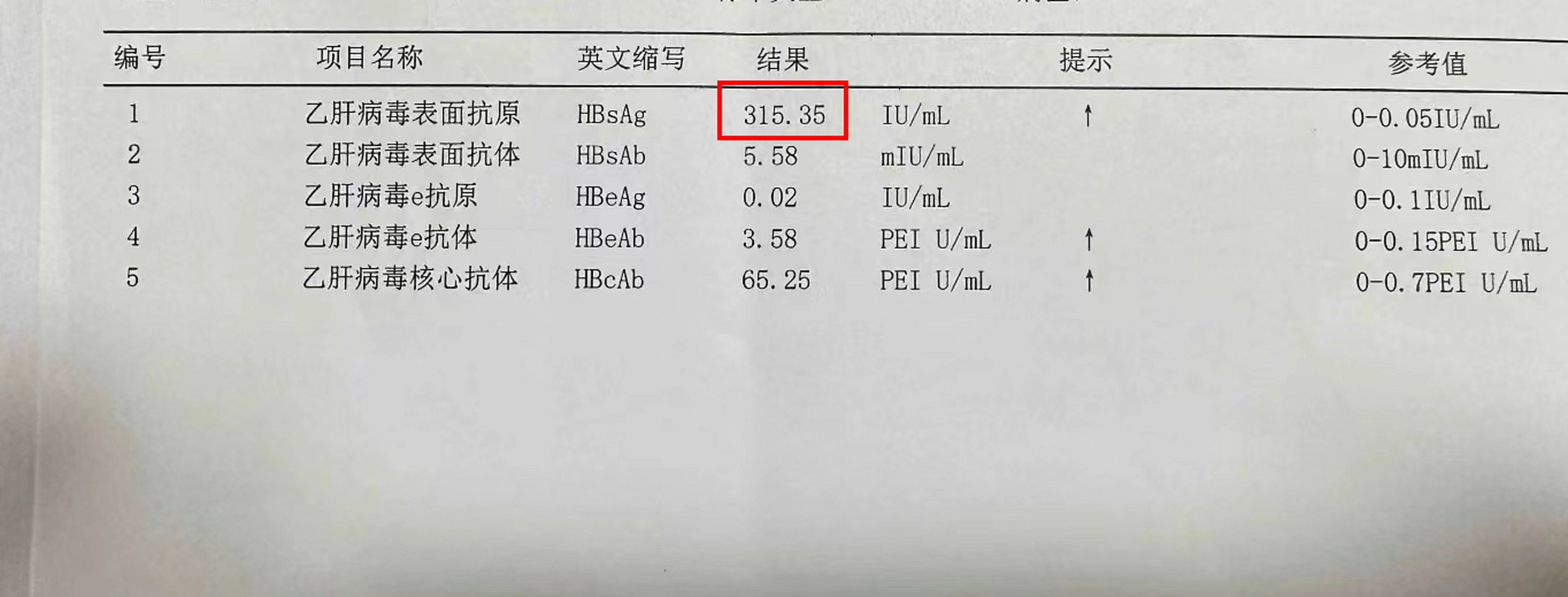 乙肝表面抗原大于1000图片