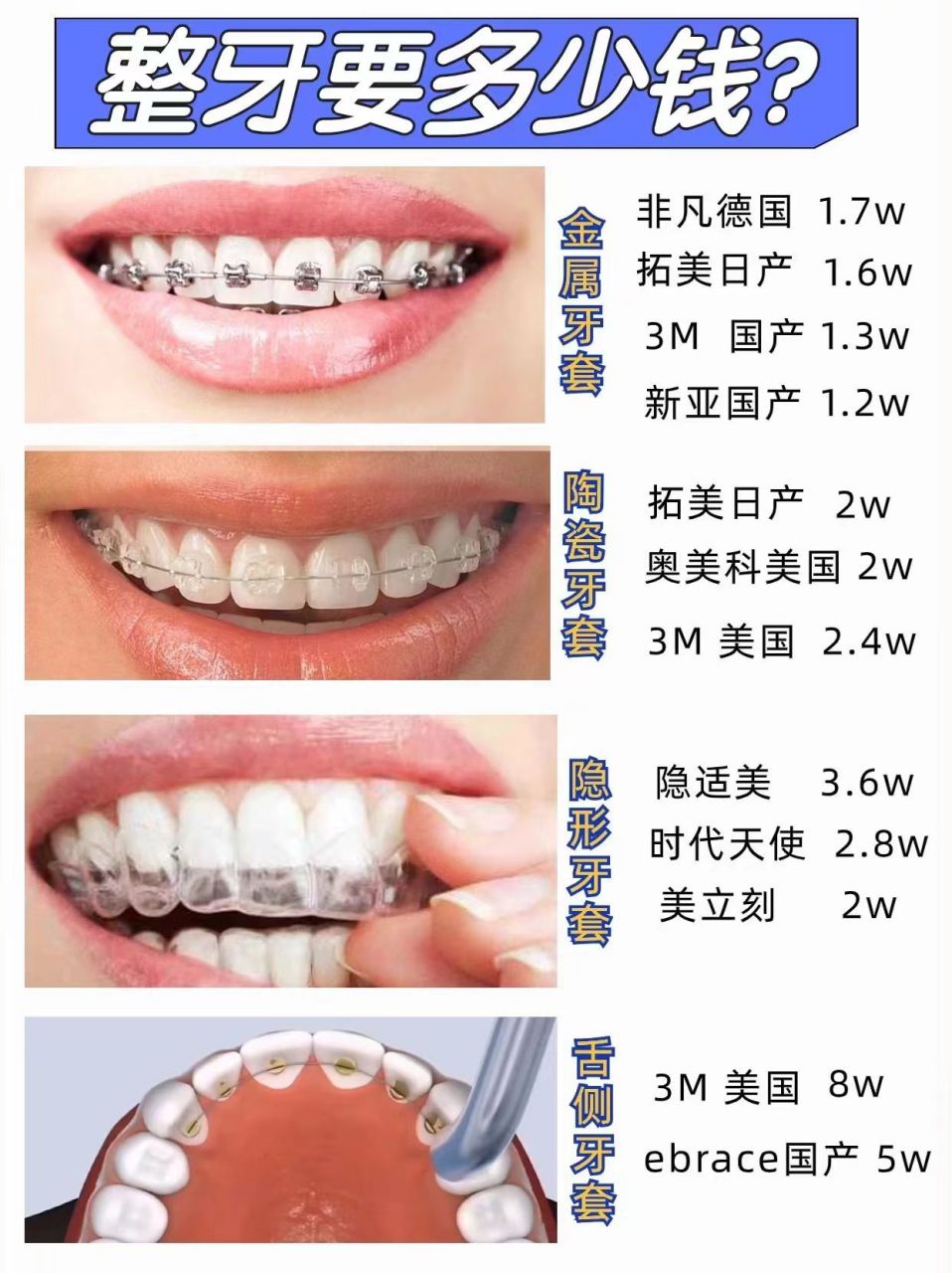 普通牙套大概多少钱图片