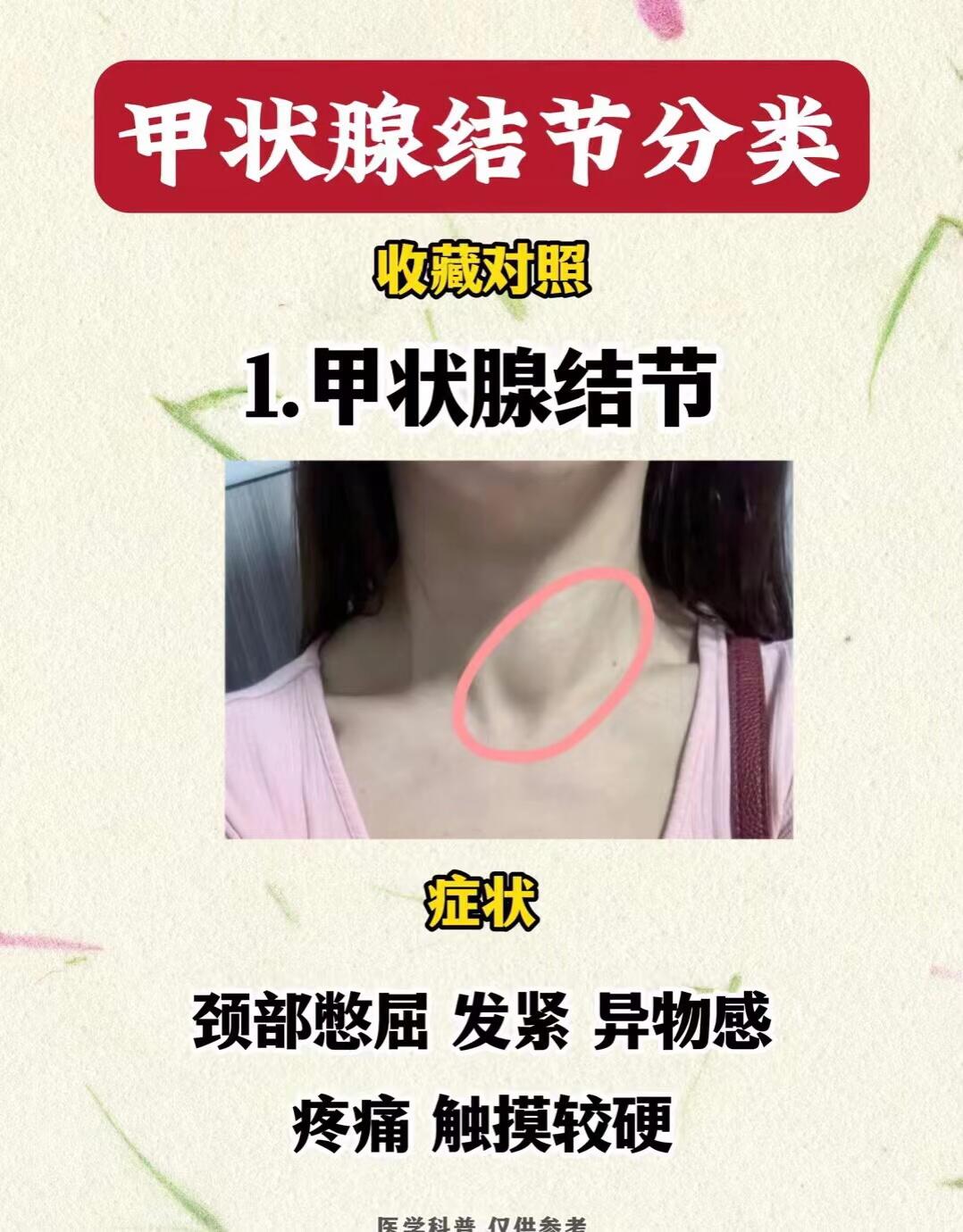 甲状腺结节类.@中医结节专家张云飞的动态