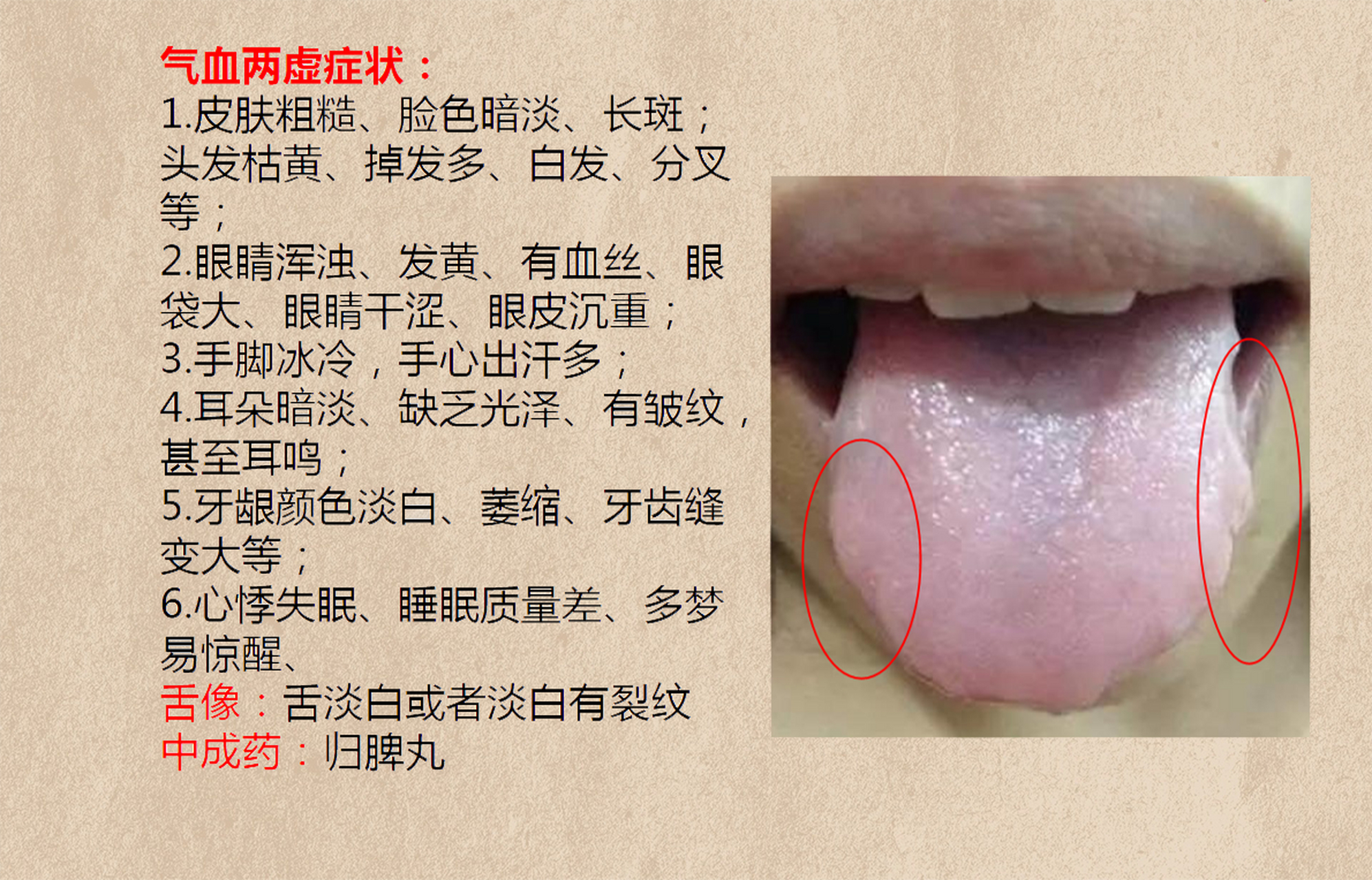 气血两虚舌苔图图片