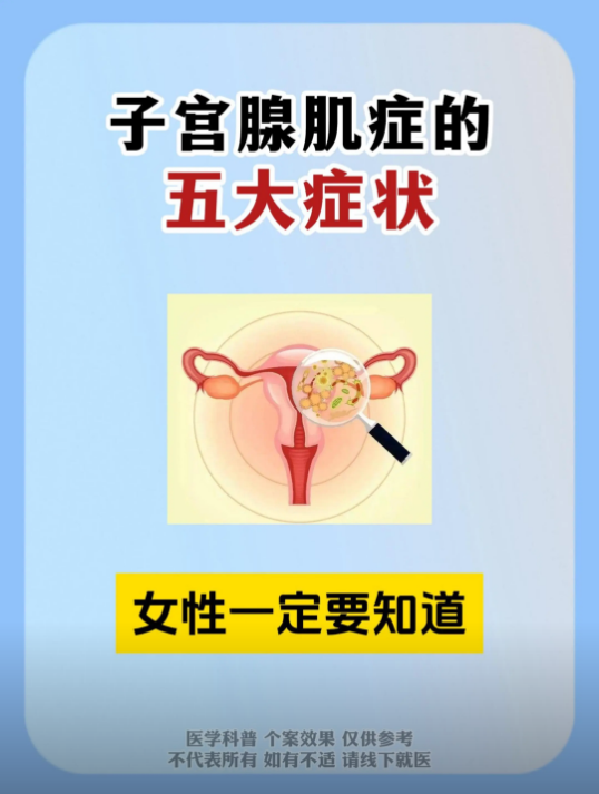 子宫腺肌症有哪些症状图片