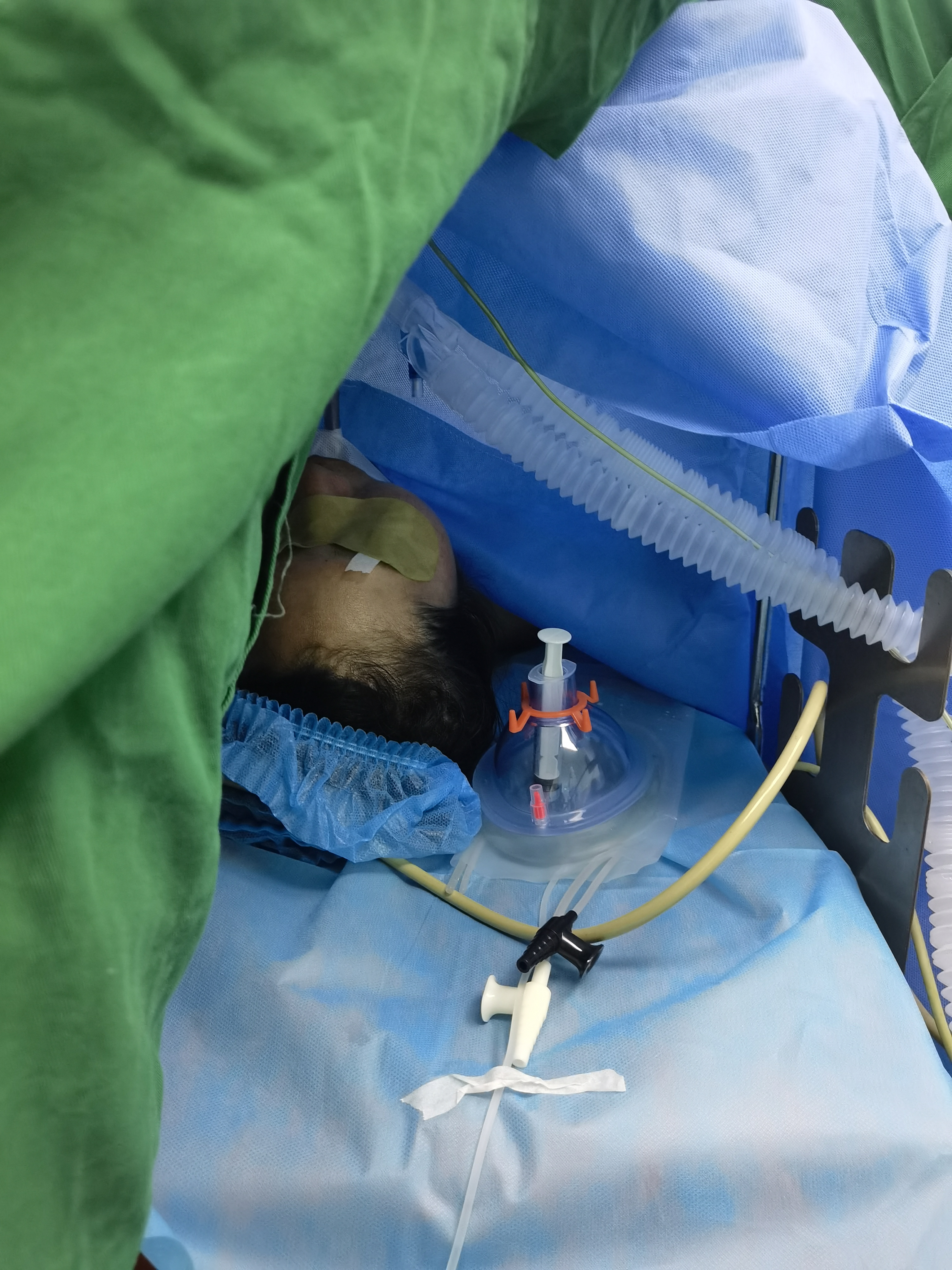 今天这位女患者,47岁,未婚