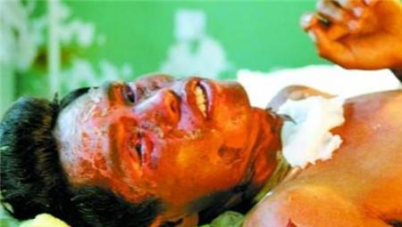 2003年,齐齐哈尔市爆发了一起严重的毒气事件,事件造成了44人入院,1人