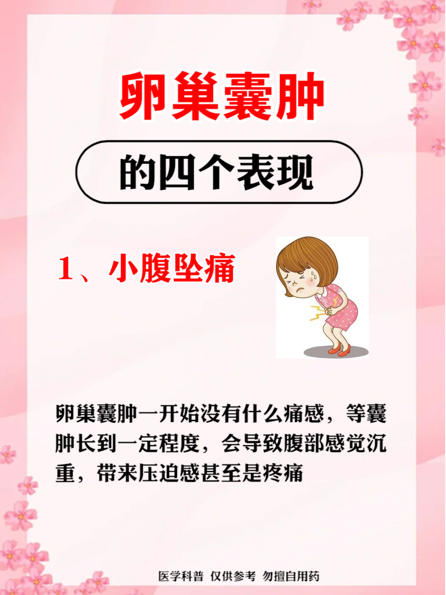 卵巢囊肿的四个表现!#动态连更挑战