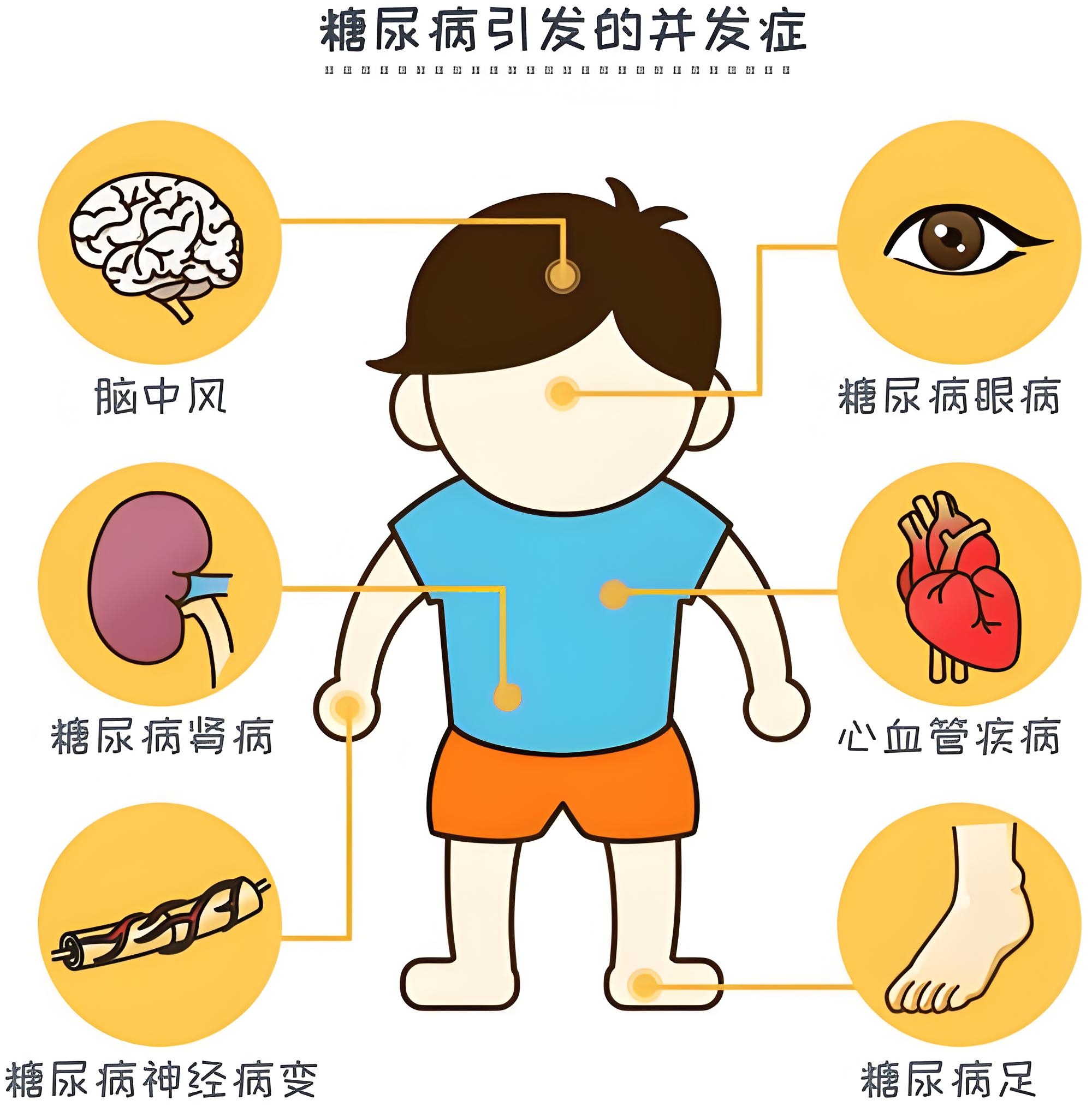 糖尿病是一种终身性代谢性疾病,其特征在于慢性高血糖.