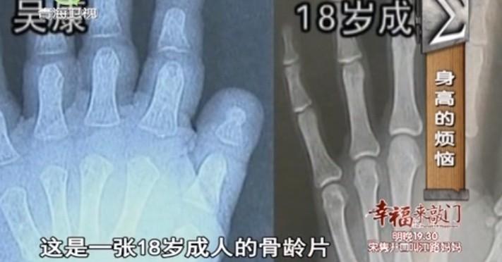 2012年的时候,吴康被邀请上了一档综艺节目《丁点真相》,这档节目的