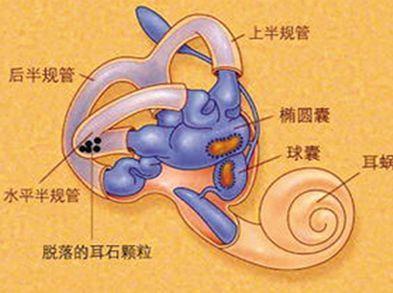耳石症复位后,仍约有20%的.@中医刘燕医生的动态