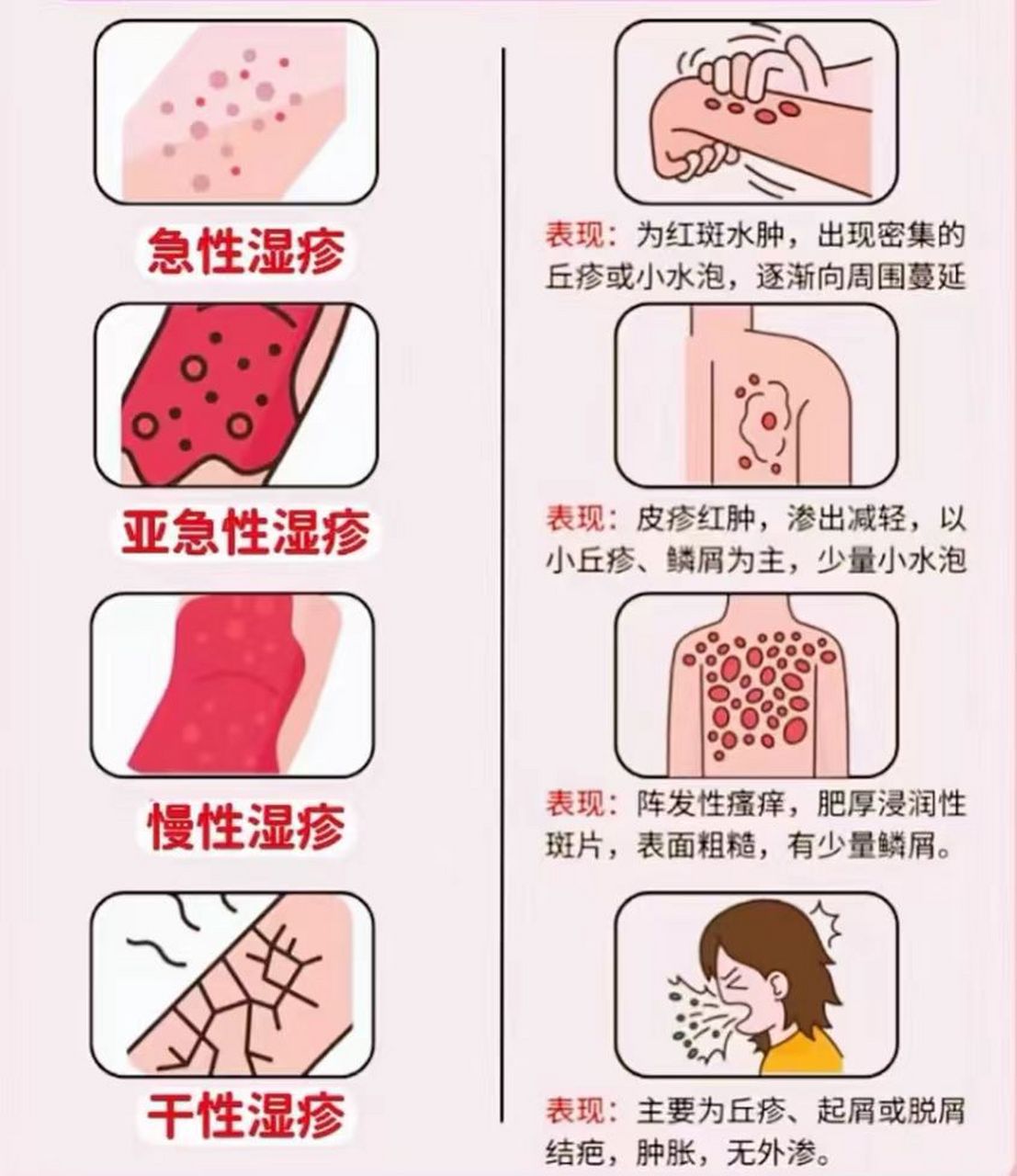 湿疹常见4种类型,一图带你清楚了解!