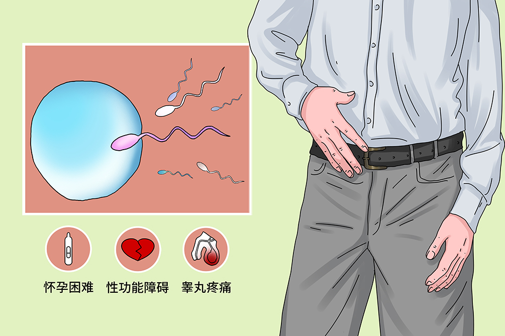 重度弱精症图片