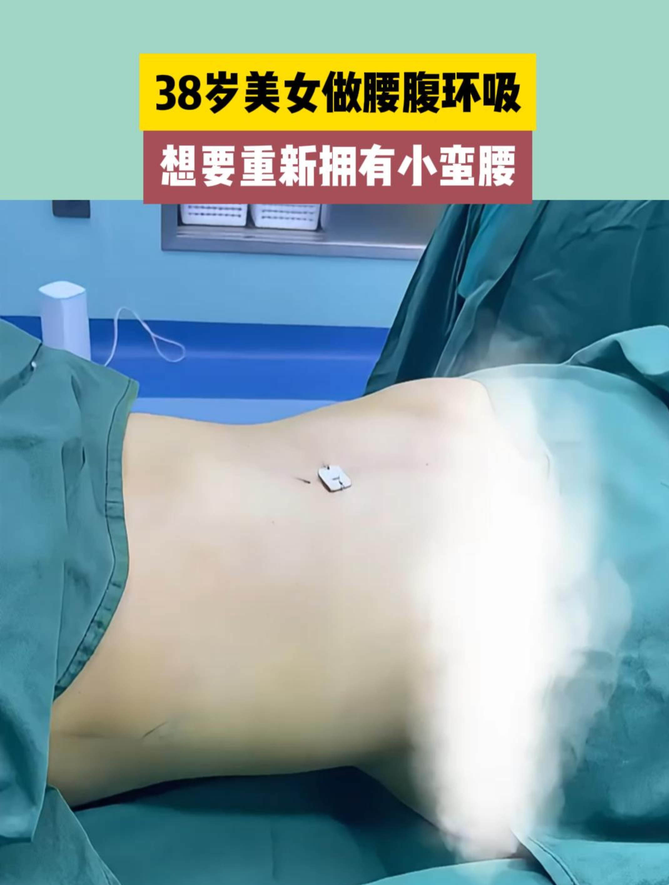 38岁美女做腰腹环吸,想要重新拥有小蛮腰