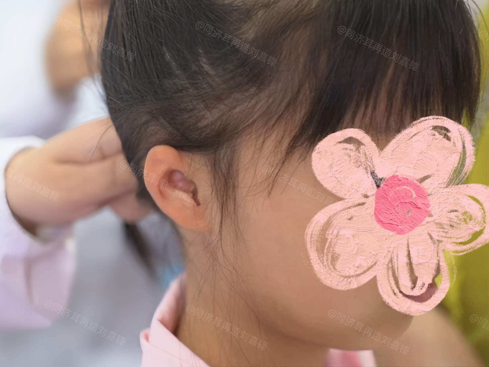 妈妈在门诊指着爸爸问我,"他耳朵上也有个附耳,结果老二出生也有