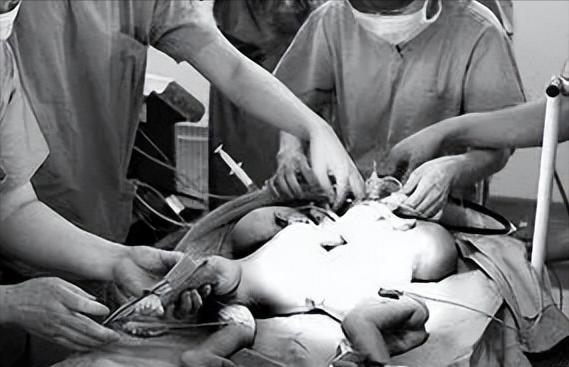 乌克兰一男子娶了一对"连体姐妹",婚后生活幸福甜蜜