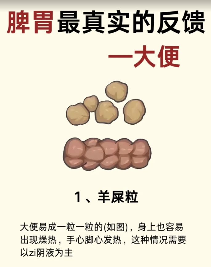 为什么拉不出来屎