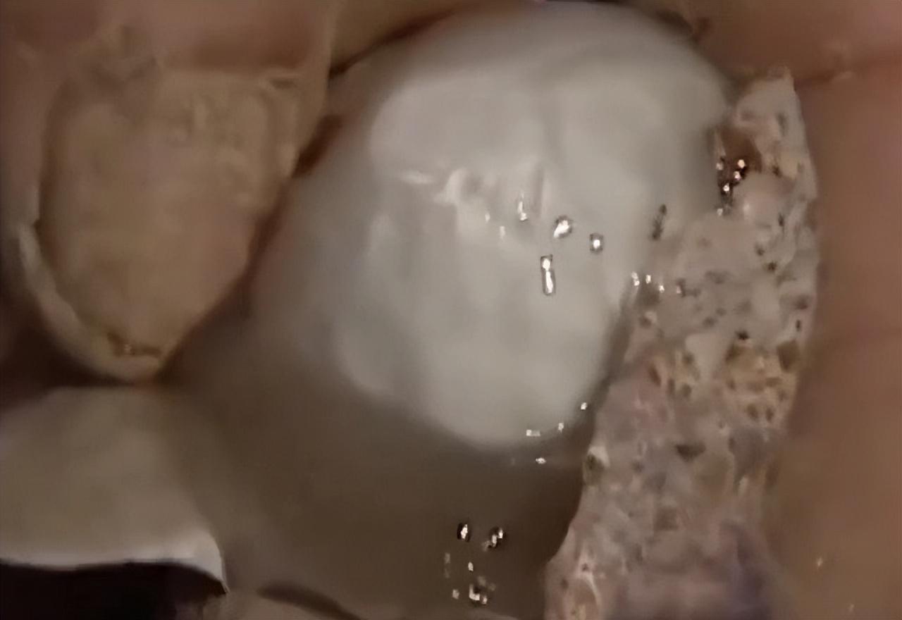 忙着忙着,老孙发现带的农药不够了,就准备拿手机给家人打电话,让他们