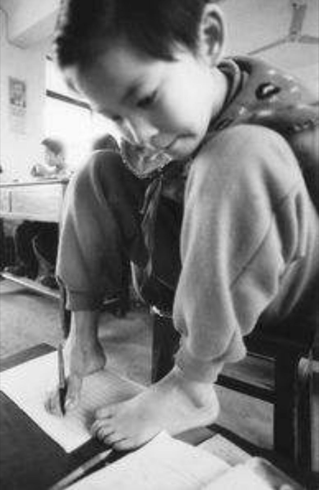 回顾:女孩3岁爬电线杆,被高压电击成残废,她却逆袭成为主持人