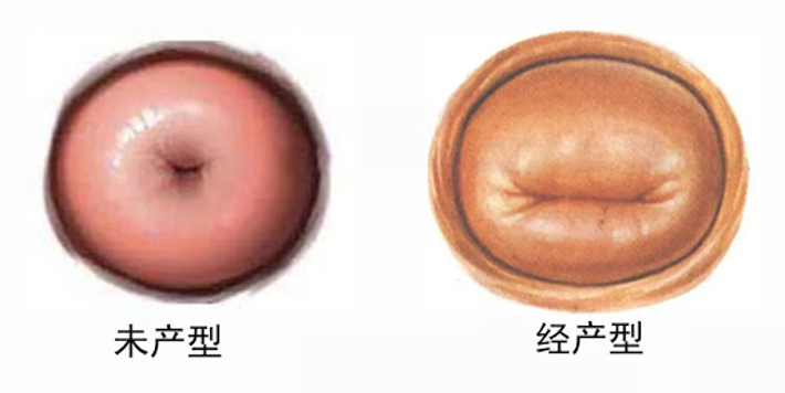 做过人流的宫颈口照片图片