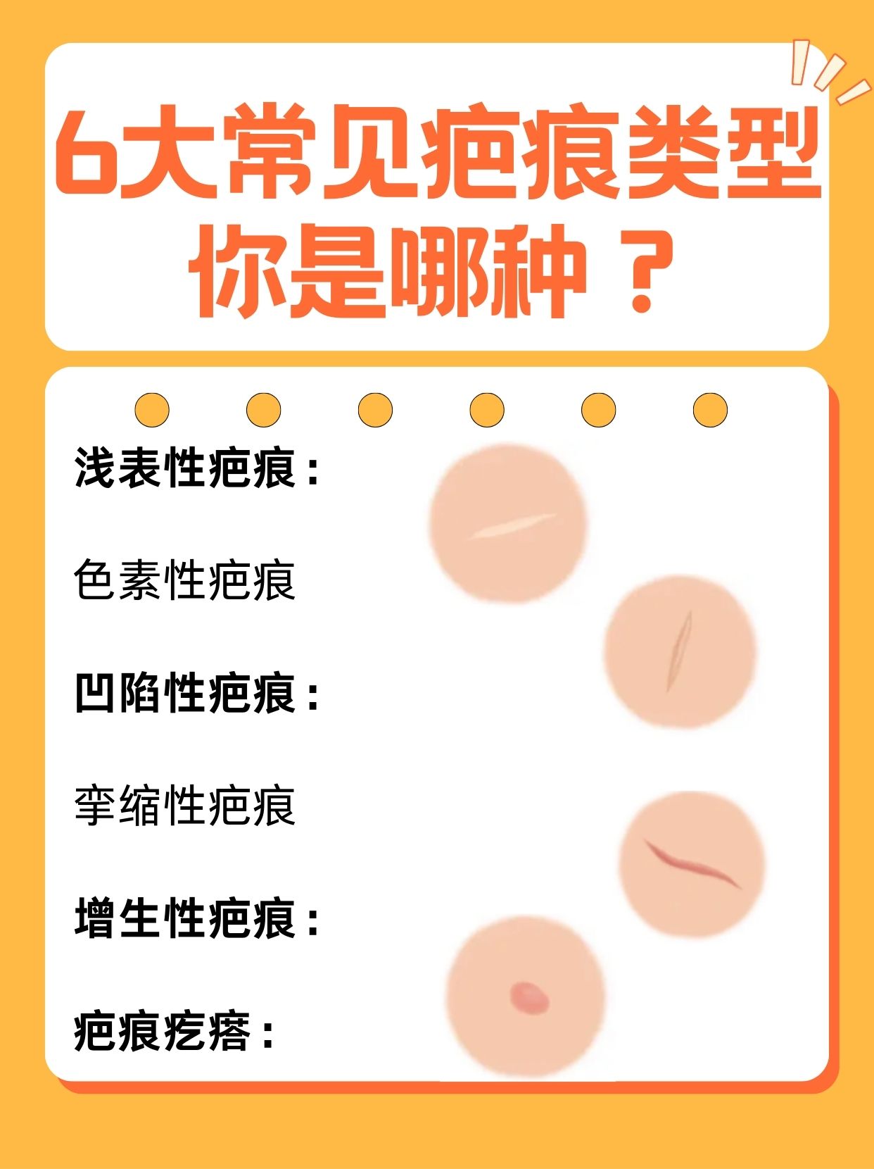 1,浅表性疤痕:一般只累及表皮或真皮浅层,外观稍粗糙,有时有色素沉着