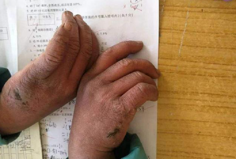 出生在云南贫困小山村的王福满,是一个典型的留守儿童.
