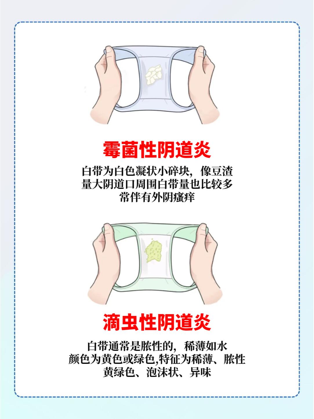 女性白带自查图,看看你的白带正常吗?#母亲节送妈妈一份健康