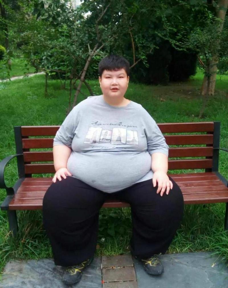 回顾:14岁男孩被父母喂到300斤,两次切胃,临死前哭喊:我要减肥