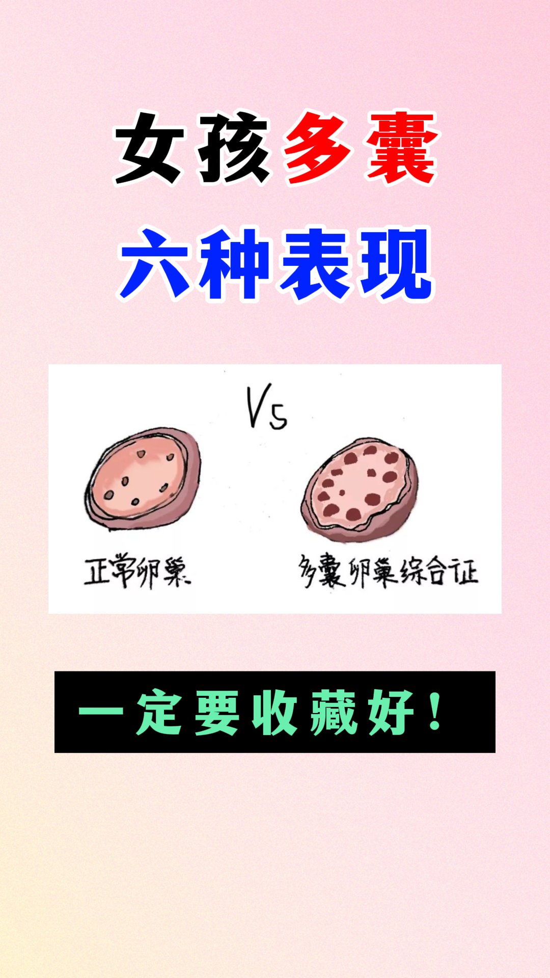 多囊l卵巢病_多囊卵巢问题严重吗?