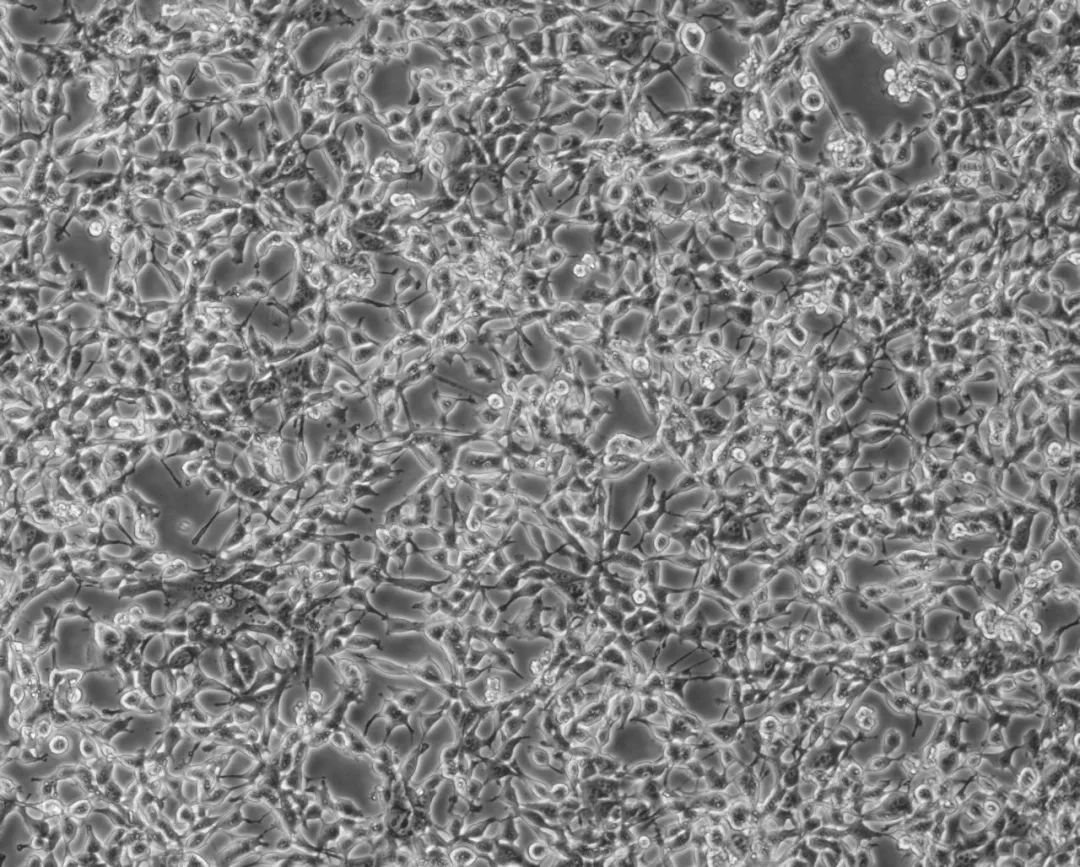 CT26.WT(小鼠结肠癌细胞)培养教程